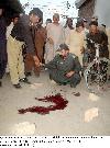 Previous picture :: Dr.Qamar, who was gunned down by unidentified gunmen at Sirki road, Quetta