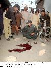 Dr.Qamar, who was gunned down by unidentified gunmen at Sirki road, Quetta