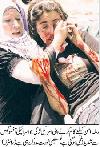 A Palestine woman helps a USA peace worker girl as she was injured by shelling of Israeli Army